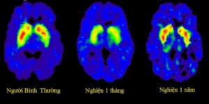 c04fb84c4ece498fb752995d3c6f3100